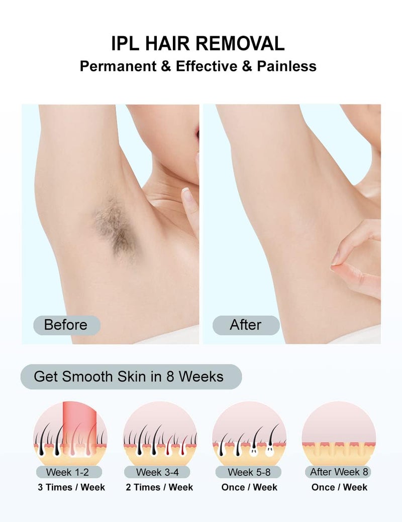 IIDEA IPL Hair Removal,Laser Hair Removal At-Home for Women Men, 999,999 Flashes Permanent Hair Removal Device on Facial Legs Arms Bikini Line, White - Image 2